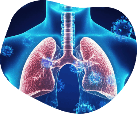 COPD and Asthma